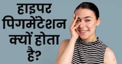हाइपर पिंगमेंटेशन क्या है और कैसे किया जाता है इसका इलाज