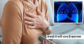 Lung health problems: किसी के लिए भी जानलेवा हो सकता है फेफड़ों में पानी भरना, जानें क्या है इसकी रोकथाम