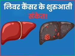 लिवर कैंसर के पहले स्टेज में ही दिखने लगते हैं ये 10 लक्षण, इन जांचों के बाद तुरंत शुरू कर दें उपचार
