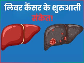 लिवर कैंसर के पहले स्टेज में ही दिखने लगते हैं ये 10 लक्षण, इन जांचों के बाद तुरंत शुरू कर दें उपचार