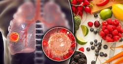 लंग्स कैंसर की सर्जरी के बाद क्या खाएं? जानिए जल्दी रिकवरी करने में मदद करेंगे ये 4 फूड्स