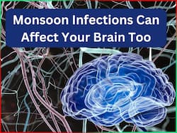 5 Common Monsoon Infections And Their Neurological Manifestations