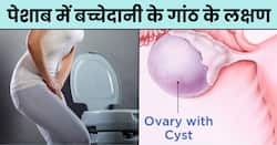 बच्चेदानी में गांठ होने पर पेशाब में नजर आते हैं ये 4 संकेत, अधिकतर महिलाएं करती हैं इग्नोर