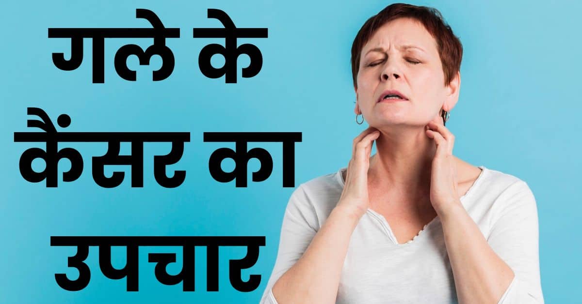 Gale ke cancer ke lakshan गले के कैंसर कितने प्रकार के होते हैं