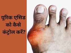 बढ़ा हुआ यूरिक एसिड हो सकता है घातक! जाने कैसे करें कंट्रोल