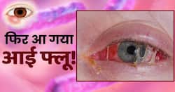 Eye Flu Preventions: आई फ्लू से बचने का ये है आसान तरीका