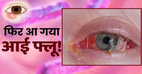 Eye Flu Preventions: आई फ्लू से बचने का ये है आसान तरीका Eye Flu Preventions: आई फ्लू से बचने का ये है आसान तरीका