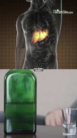 Liver Cirrhosis causes