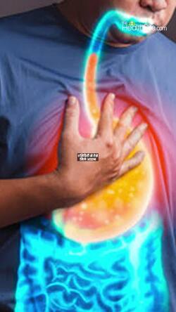 Acidity relief home remedies