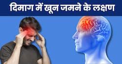 इन 5 संकेतों से समझ जाएं दिमाग में बन रहा है ब्लड क्लॉट, स्थिति गंभीर होने से पहले करवाएं अपना इलाज