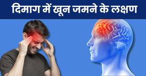 इन 5 संकेतों से समझ जाएं दिमाग में बन रहा है ब्लड क्लॉट, स्थिति गंभीर होने से पहले करवाएं अपना इलाज