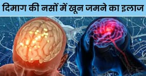 दिमाग की नसों में खून जमने पर अपनाएं ये 5 चमत्कारी उपाय, मिनटों में खुल जाएंगी बंद नसें