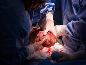 Woman Suffering From Rheumatoid Arthritis, Hypertension Gives Birth After Unsuccessful Pregnancies