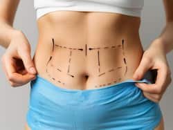 Know About The 7 Types Of Cosmetic Surgeries For The Body And Their Benefits