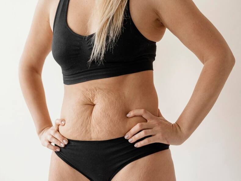 Know About The 7 Types Of Cosmetic Surgeries For The Body And Their Benefits