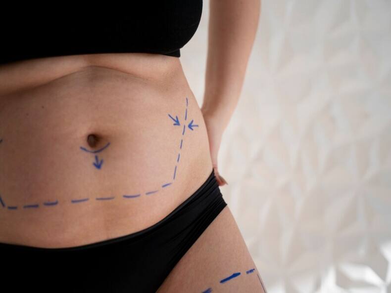 Know About The 7 Types Of Cosmetic Surgeries For The Body And Their Benefits