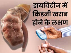 ये 5 संकेत बताते हैं कि हाई ब्लड शुगर के कारण किडनी होने लगी है डैमेज, डायबिटीज के मरीज न करें नजरअंदाज