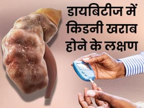ये 5 संकेत बताते हैं कि हाई ब्लड शुगर के कारण किडनी होने लगी है डैमेज, डायबिटीज के मरीज न करें नजरअंदाज ये 5 संकेत बताते हैं कि हाई ब्लड शुगर के कारण किडनी होने लगी है डैमेज, डायबिटीज के मरीज न करें नजरअंदाज
