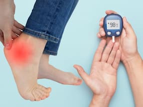 Diabetes Symptoms In Men 40s: 7 Unusual Signs of High Blood Sugar Levels In Legs and Feet At Night