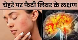 चेहरे पर दिखाई दें ये 4 लक्षण तो समझ जाएं अंदर ही अंदर सड़ रहा है लिवर, तुरंत भागें डॉक्टर के पास