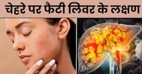 चेहरे पर दिखाई दें ये 4 लक्षण तो समझ जाएं अंदर ही अंदर सड़ रहा है लिवर, तुरंत भागें डॉक्टर के पास चेहरे पर दिखाई दें ये 4 लक्षण तो समझ जाएं अंदर ही अंदर सड़ रहा है लिवर, तुरंत भागें डॉक्टर के पास