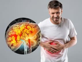 Fatty Liver Treatment At Home: 5 Nighttime Drinks That Can Prevent Fat Buildups In Liver