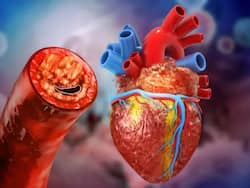 घर बैठे 2 मिनट में ऐसे पता लगाएं हार्ट में ब्लॉकेज है या नहीं, बस कर लें ये 3 सिंपल टेस्ट