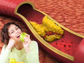 High Cholesterol Management: 10 Ayurvedic Remedies to Lower Cholesterol and Prevent Stroke