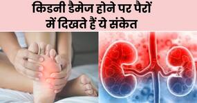 किडनी डैमेज होने पर पैरों में दिखाई देते हैं ये 4 संकेत, 90 फीसदी लोग साधारण समझकर करते हैं इग्नोर किडनी डैमेज होने पर पैरों में दिखाई देते हैं ये 4 संकेत, 90 फीसदी लोग साधारण समझकर करते हैं इग्नोर