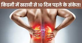 किडनी डैमेज होने से 10 दिन पहले शरीर देता है ये 5 संकेत, 99.9 फीसदी लोग करते हैं इग्नोर किडनी डैमेज होने से 10 दिन पहले शरीर देता है ये 5 संकेत, 99.9 फीसदी लोग करते हैं इग्नोर