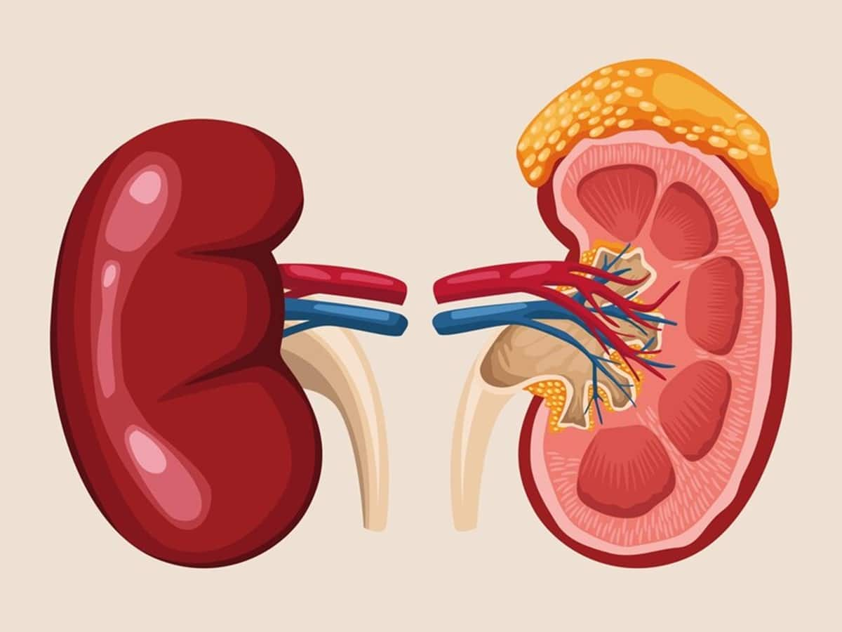 Kidney Diseases