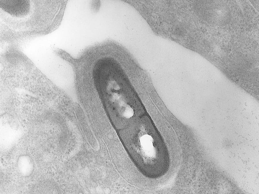 Amid Listeria Outbreak In United States and Canada, Know How You Can Prevent The Infection