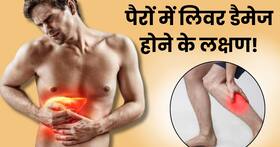 पैरों पर दिखाई देते हैं लिवर डैमेज के ये 3 संकेत, अधिकतर लोग सामान्य समझकर करते हैं इग्नोर पैरों पर दिखाई देते हैं लिवर डैमेज के ये 3 संकेत, अधिकतर लोग सामान्य समझकर करते हैं इग्नोर
