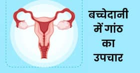 कैंसर का कारण बन सकता है बच्चेदानी में गांठ का होना, आयुर्वेदिक डॉक्टर से जानिए लक्षण और उपचार कैंसर का कारण बन सकता है बच्चेदानी में गांठ का होना, आयुर्वेदिक डॉक्टर से जानिए लक्षण और उपचार