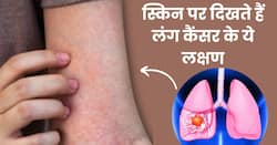 Lung Cancer की ओर इशारा करते हैं त्वचा में होने वाले ये 5 बदलाव, इग्नोर करना पड़ सकता है भारी