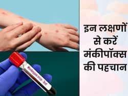 फ्लू जैसे दिखते हैं मंकीपॉक्स के लक्षण, जानें कैसे करें इस बीमारी की पहचान और बचाव के उपाय
