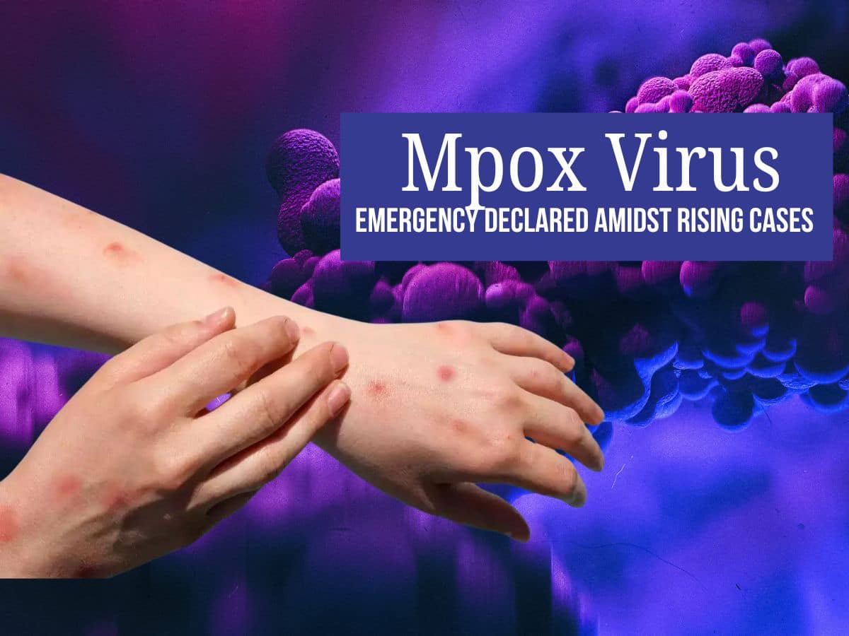 Mpox Virus Cases Explodes In Africa, Public Health Emergency Declared