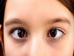 рдмрдЪреНрдЪреЛрдВ рдХреА рдЖрдВрдЦреЛрдВ рдореЗрдВ рднреЗрдВрдЧрд╛рдкрди рдХреЗ рд╣реЛ рд╕рдХрддреЗ рд╣реИрдВ рдпреЗ 5 рдХрд╛рд░рдг, рдирд╛ рдХрд░реЗрдВ рд╕рдорд╕реНрдпрд╛ рдХреА рдЕрдирджреЗрдЦреА