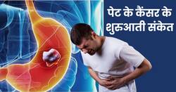 पेट के कैंसर के शुरुआती स्टेज में शरीर देने लगता है ये 5 संकेत, समय पर पहचानकर कराएं इलाज