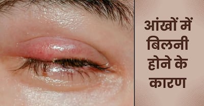Aankh me Bilni Hone ke Karan | इन 5 कारणों से हो सकती हैं आंखों में ...