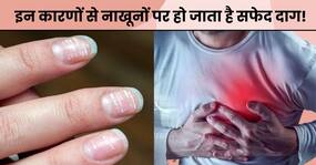 नाखूनों पर सफेद धब्बे इन 7 बीमारियों की ओर करते हैं इशारा, 90 फीसदी लोग करते हैं नजरअंदाज