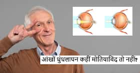 आंखों में धुंधलापन या देखने में परेशानी कहीं मोतियाबिंद तो नहीं? जानें क्या है मोतियाबिंद और उसके नुकसान