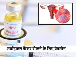 सर्वाइकल कैंसर से बचाव के लिए अपने बच्चों में ये वैक्सीन है बहुत जरूरी, डॉक्टर ने दी जानकारी