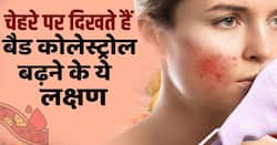 Bad Cholesterol Signs On Face: चेहरे पर दिखते हैं बैड कोलेस्ट्रॉल के ये 5 लक्षण!