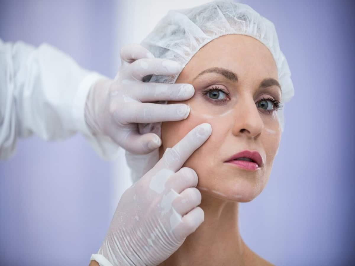 What Are The Different Types Of Cosmetic Surgeries That One Can Avail For Their Face?