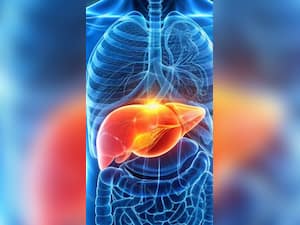 Prevent Fat Buildup In The Liver By Doing These 6 Things