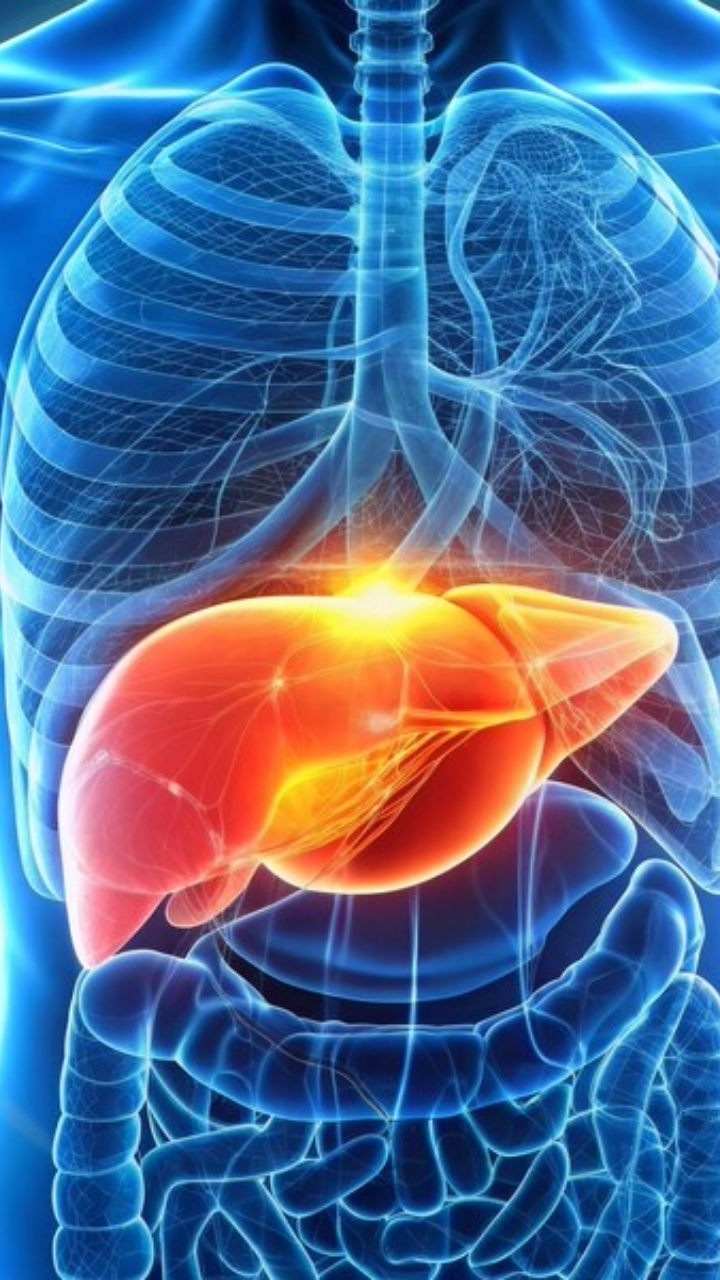 Prevent Fat Buildup In The Liver By Doing These 6 Things