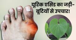 जोड़ों में जमा यूरिक एसिड के क्रिस्टल को निकाल फेंकती है ये 1 जड़ी बूटी, जानिए यूरिक एसिड कम करने के उपाय