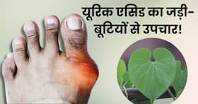 जोड़ों में जमा यूरिक एसिड के क्रिस्टल को निकाल फेंकती है ये 1 जड़ी बूटी, जानिए यूरिक एसिड कम करने के उपाय