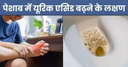 पेशाब में दिखते हैं यूरिक एसिड बढ़ने के ये 5 लक्षण, 90 फीसदी लोग साधारण समझकर करते हैं इग्नोर